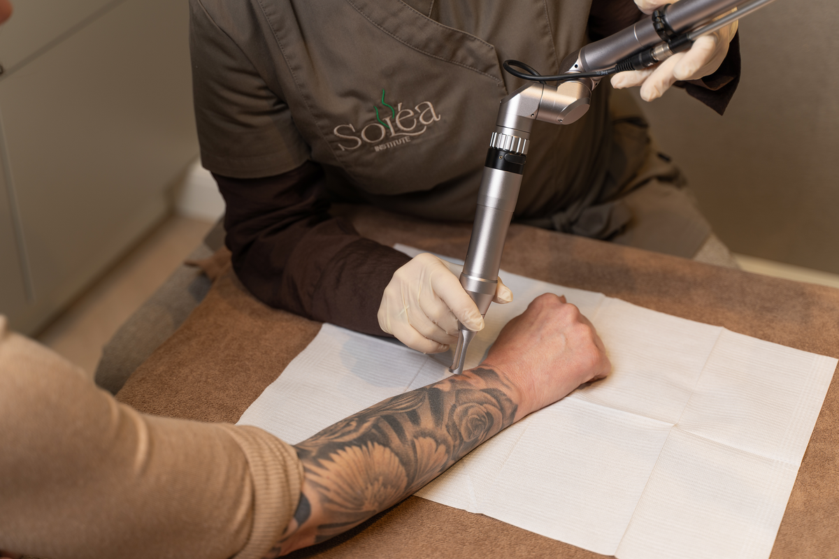 Laser tattooverwijdering bij Soléa Institute