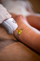 Laserontharing Gentle Max Pro Plus