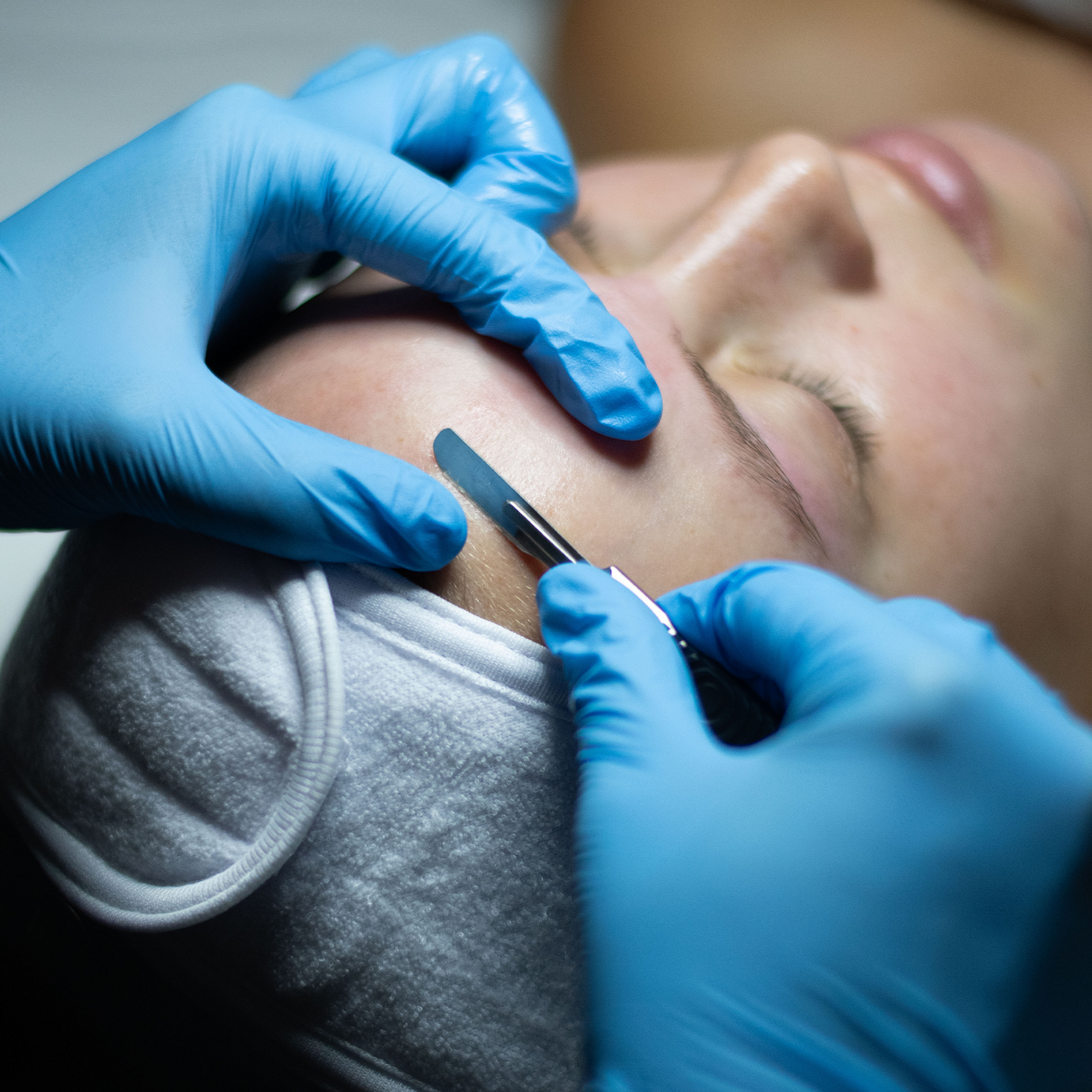 Dermaplaning behandeling bij Soléa Institute