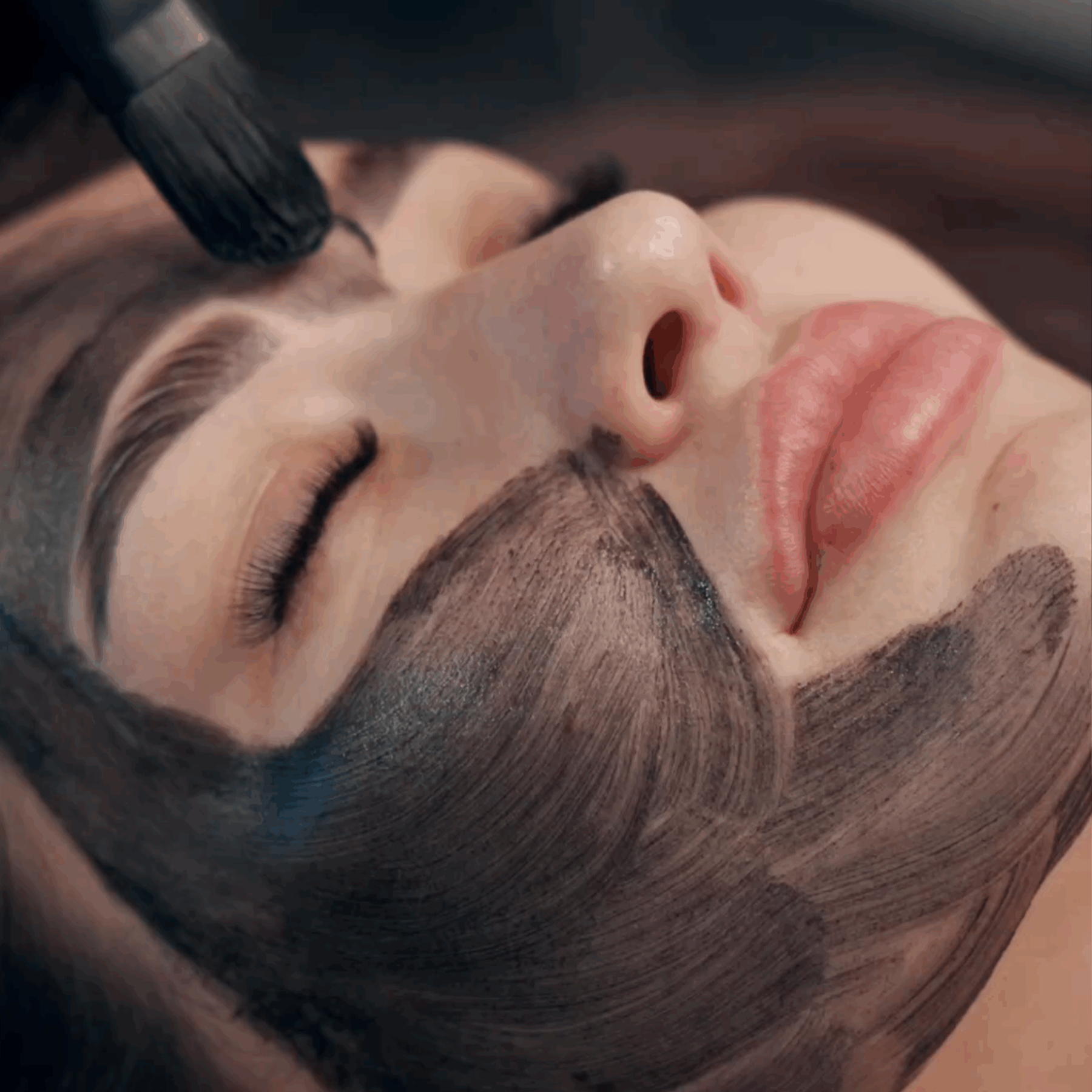 Carbon Laser Peel bij Soléa Institute